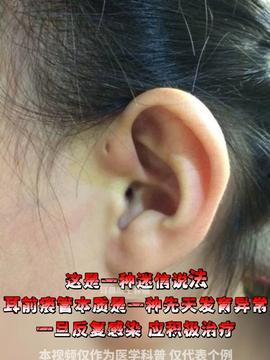 打耳洞的视频大全,视频大全带你轻松入门